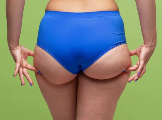 La culotte de cheval : causes, solutions et astuces pour l'atténuer