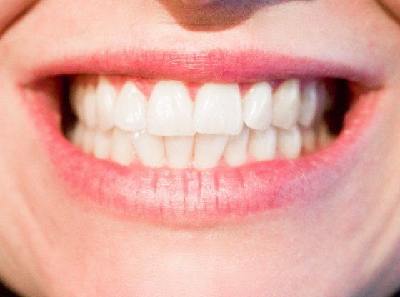 Comment avoir des dents blanches : les secrets pour un sourire éclatant