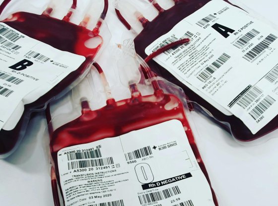 Groupes sanguins : ce qu'ils révèlent sur votre santé