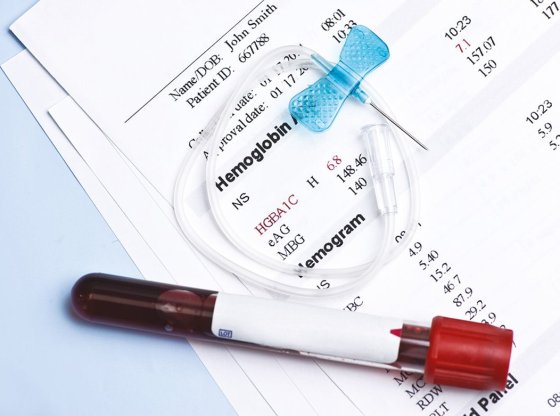 Diabète : qu'est-ce que l'hémoglobine glyquée et pourquoi c'est crucial ?