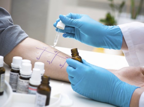 Désensibilisation : la solution miracle contre vos allergies ?