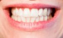 Comment avoir des dents blanches : les secrets pour un sourire éclatant