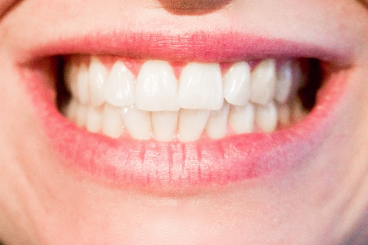 Comment avoir des dents blanches : les secrets pour un sourire éclatant